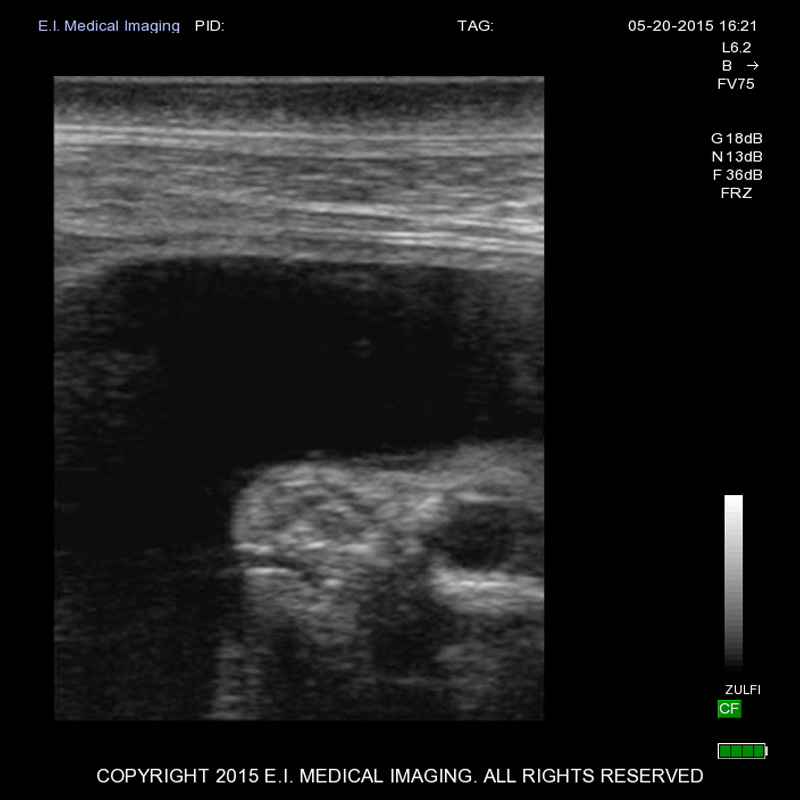 Pictured here is Ratu’s fetus is at 117 days old. In this stage of development, the fetus is much larger than an embryo. In the lower right corner of the image, you can clearly see the calf’s head. This is a profile view, and the circular dark spot is the fetus’ eye. To the left of the eye, you can see its nose and mouth. The new calf will be the second rhino born at the Sumatran Rhino Sanctuary in Indonesia’s Way Kambas National Park. Courtesy of Yayasan Badak Indonesia.